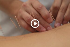 Acupuncture-Video-Marketing---Spokesperson-Video
